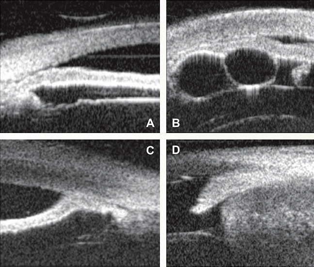 Four views of pathology on UBM